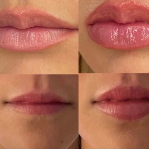 BRAND NEW IN SEALED BOX! BEAMBO THE LIP GIZMO LIP PLUMPING DEVICE - Picture 2 of 7